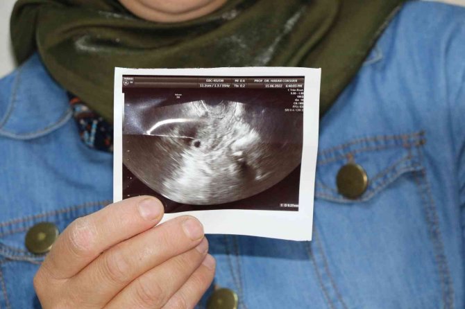 İ̇leri Yaş Ve Yumurta Tembelliği Nedeniyle Çocuk Hasreti Çekiyordu, Diyarbakır’da Bu Hasret Son Buldu