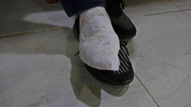 Kadını Kurtarmak İsterken Hem Ayağından Isırıldı Hem De Kolunu Kırdı
