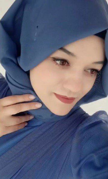 Eski Nişanlısına Kezzap Atan Şahıs "Su Saatine Bakacağım" Bahanesiyle Kapıyı Açtırmış