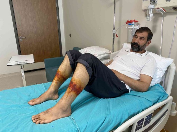 Bakırköy’deki İnşaatta Feci Olay: Baba Oğulun Dizleri Beton Döktükleri Sırada Yandı