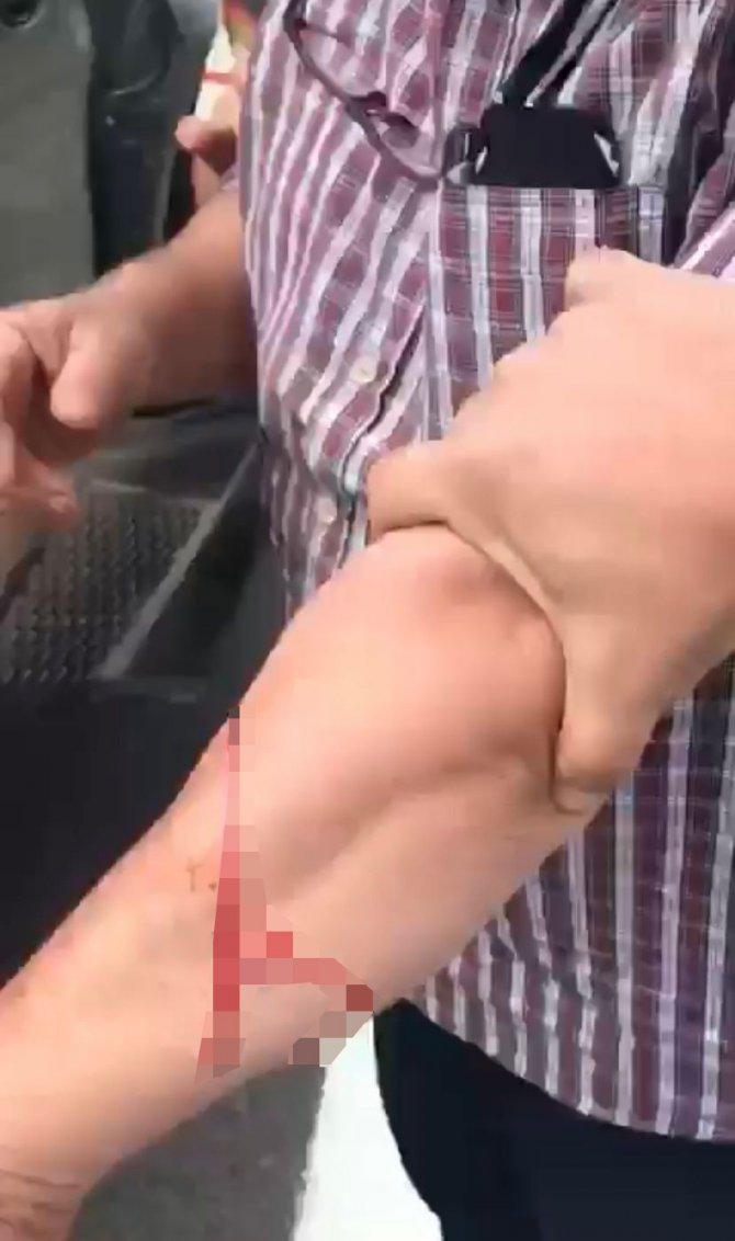 Trafikte Tartıştığı 3 Kişiyi Falçatayla Yaraladı, "Doğrarım" Diye Tehdit Etti