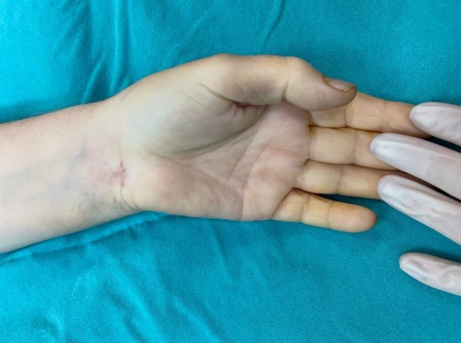 Bu Ameliyat Denizli’de İlk Defa Tekden’de Yapıldı