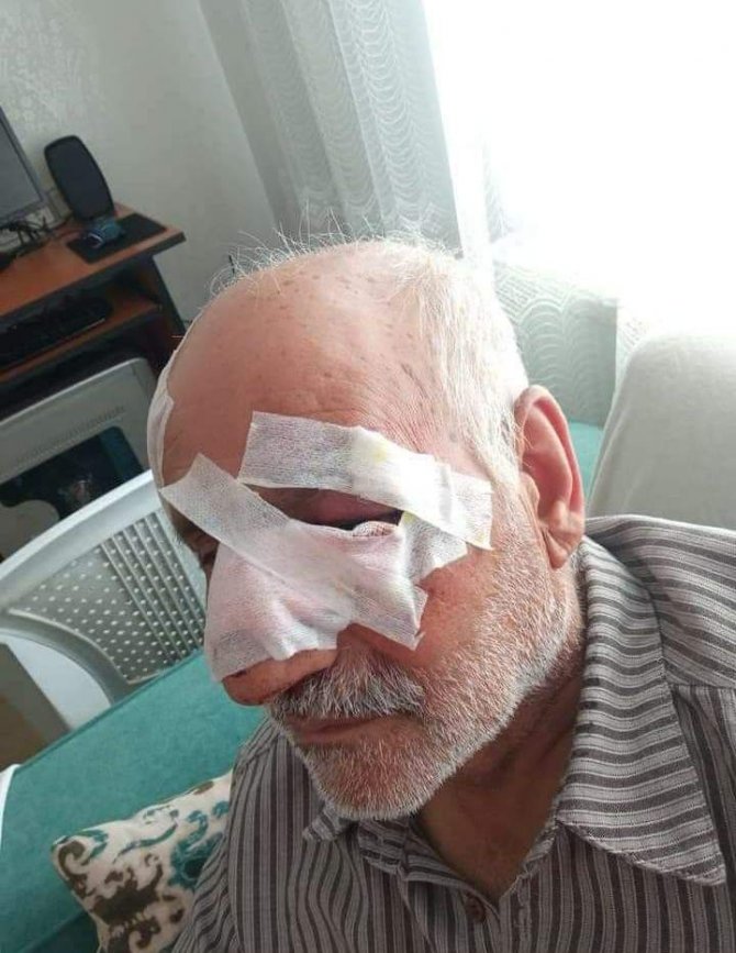Gaziantep’te Köpeklerin Saldırdığı 1 Kişi Öldü