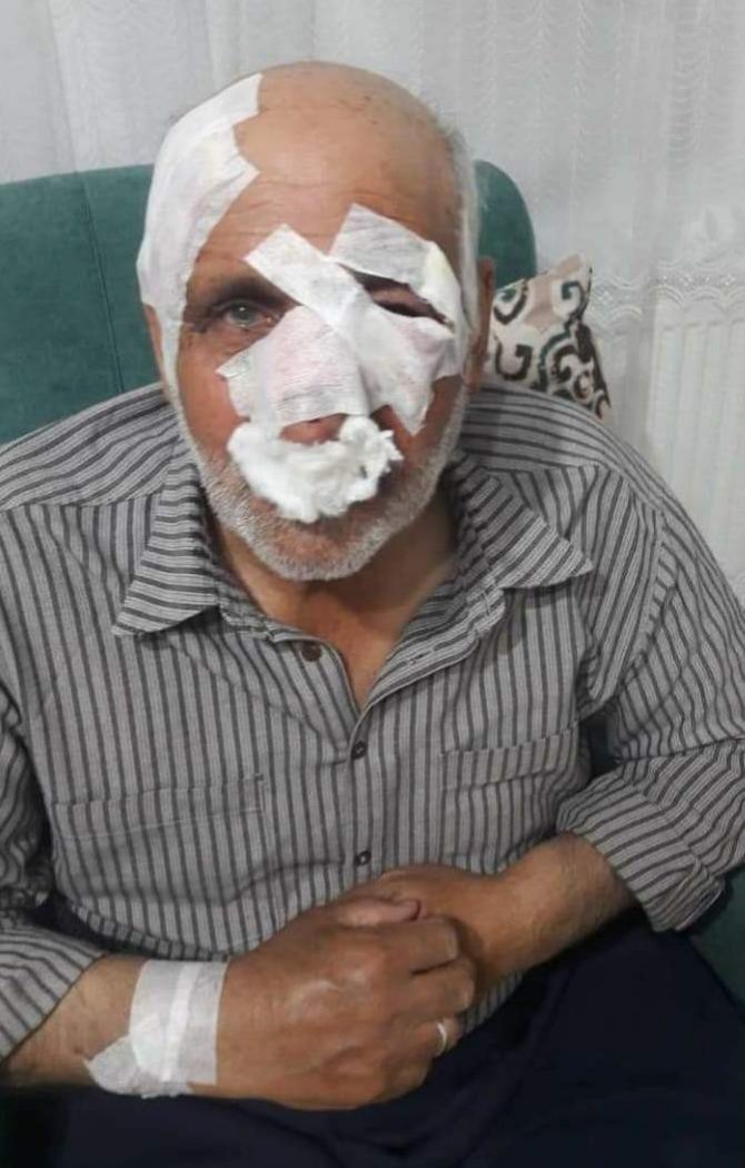Gaziantep’te Köpeklerin Saldırdığı 1 Kişi Öldü