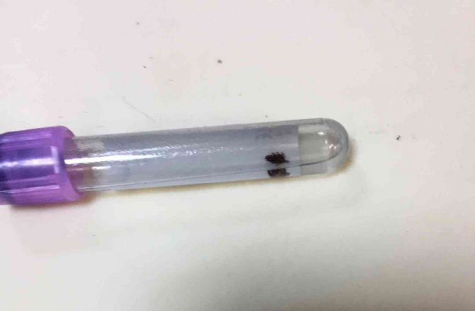 Vücuduna Yapışan Kene Acil Serviste Çıkarıldı