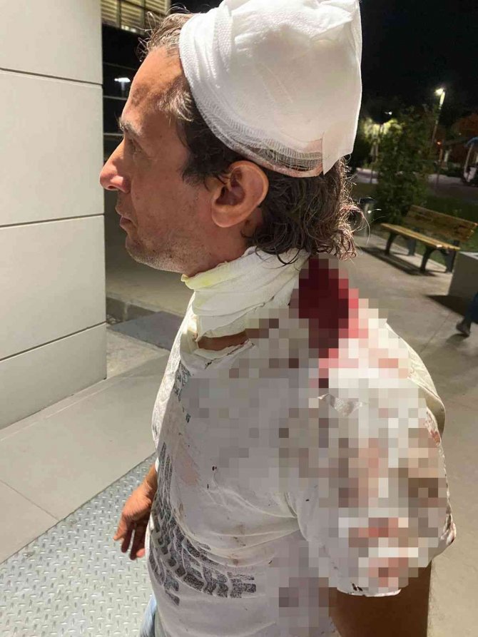 Önce Isırıp Darp Etti, Sonra Taksiyle Kaldırıma Çıkıp Ağaca Vurdu