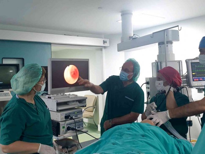 Karadeniz Bölgesi’nde İlk Kez Akciğer Hastalığının Tanısında ‘Kriobiyopsi’ Yöntemi Uygulandı