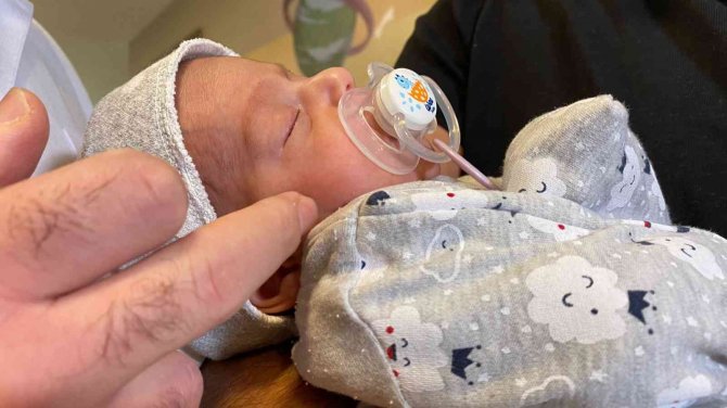 40 Bin Doğumda Bir Görülen Hastalığa Yakalanan Bebek Başarıyla Tedavi Edildi