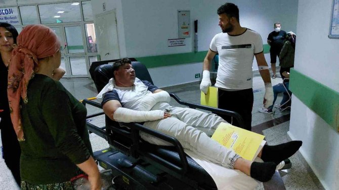 Çakmak Bomba Gibi Patladı: 2 Yaralı