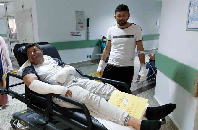 Çakmak Bomba Gibi Patladı: 2 Yaralı