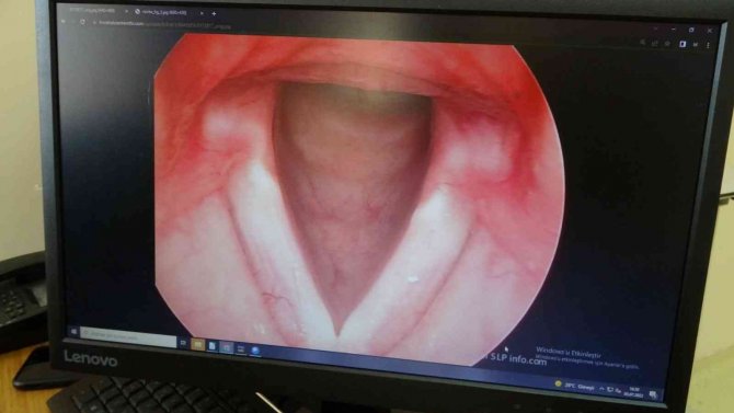 Uzmanlar Sigaranın Ses Tellerine Zararı Hakkında Uyarıyor