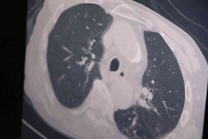 Prof. Dr. Özkaya: “Vaka Sayılarında 3 Kat Artış Var”