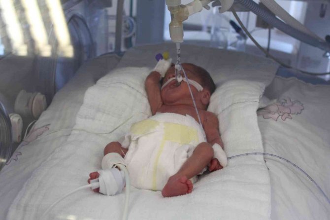 Tekirdağ’da 600 Gramlık Bebeğe Kök Hücre Nakli Yapıldı