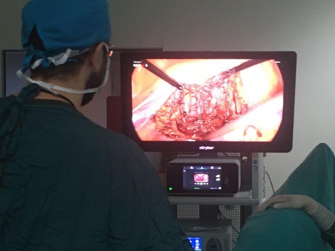 Laparoskopik Yöntemle Kapalı Olarak Prostat Kanseri Ameliyatı Yapıldı