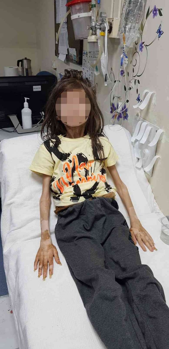 Yeğenini Çöp Evde Kilitli Tutan Teyze Çocuğa Eziyet Suçundan Gözaltına Alındı