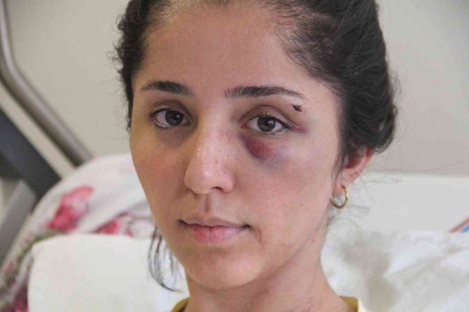 Doktor Sevgilisinin Evinde Dehşeti Yaşayan Genç Kadın 2 Saat Boyunca Darp Edildi, 5 Yerinden Bıçaklandı