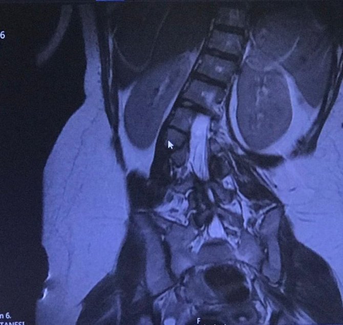 Doğduktan Sonra İlk Defa Dik Durabildi