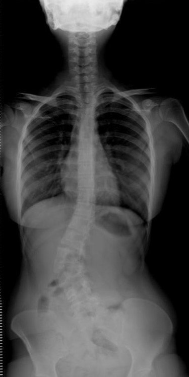 Doğduktan Sonra İlk Defa Dik Durabildi