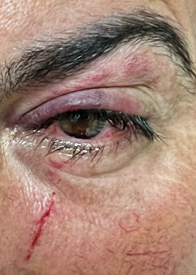 Şişeden Gelen Tehlike: "Gözünüzden Olmayın"