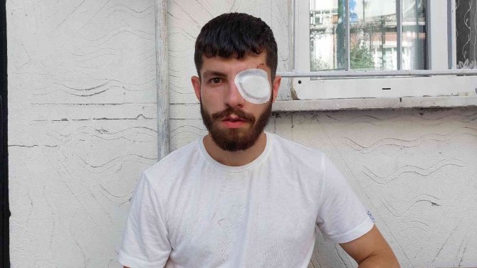 Sigortasız Çalıştırılan İşçi, Sigorta İsteyince Bardaklı Saldırıya Uğradı