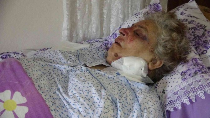 Hatay’da Yaşlı Kadın Akrabası Tarafından 34 Yerinden Bıçaklandı