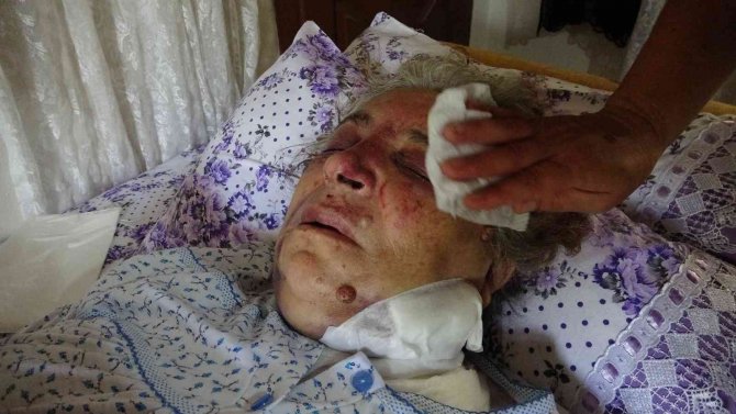 Hatay’da Yaşlı Kadın Akrabası Tarafından 34 Yerinden Bıçaklandı