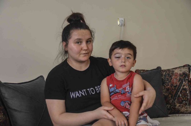 Köpeklerin Saldırdığı 3 Yaşındaki Çocuğun Yüzü Parçalandı