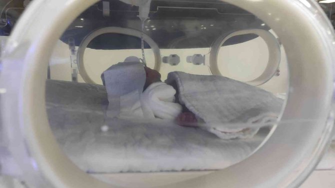 Helikopter Ambulansla Şanlıurfa’ya Getirilen 775 Gramlık Bebeğin Tedavisi Sürüyor