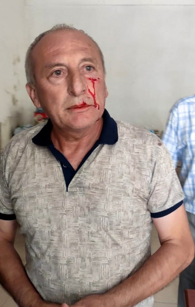 Belediye Başkanı Kaynar, Dayısının Saldırısına Uğradı