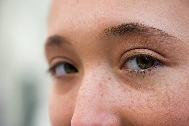 Güneş Lekeleri Mutsuzluk Sebebiniz Olmasın