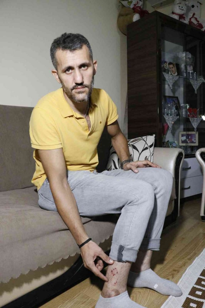 Ailesiyle Evine Giderken Köpeklerin Saldırısına Uğradı