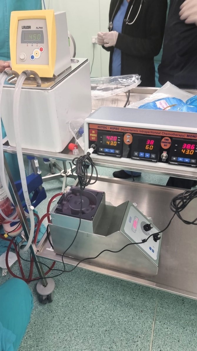 Kemoterapiden Cevap Alamayan Hastanın Hıpec Yöntemiyle Tümörleri Yok Edildi