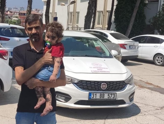 Vücudunda Leke Ve Kitle İle Doğan Bebek Tedavi Ediliyor