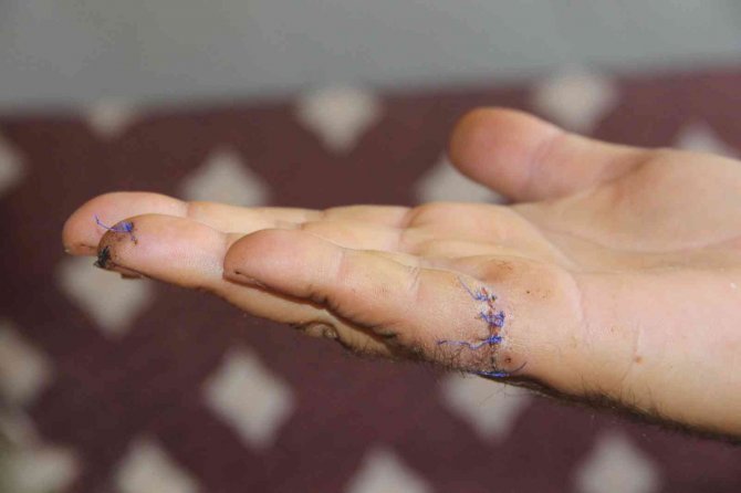 Tıraş Makinesi Yere Düştü, Bir Ailenin Huzuru Yok Oldu