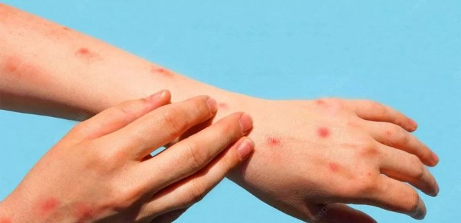 “Domates Gribinin Kontrol Altına Alınması Zor Görünüyor”