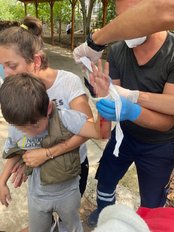 7 Yaşındaki Çocuğun Eline Sivri Demir Saplandı
