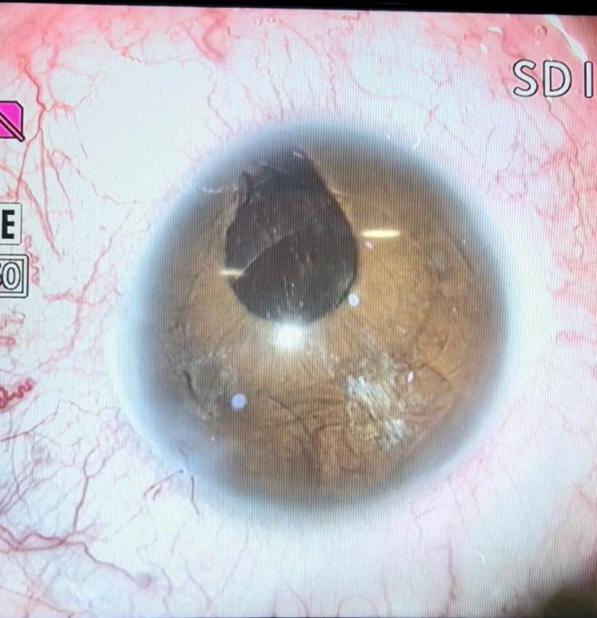 Göz Bebekleri Yere Bakan Gurbetçi İ̇zmir’de Sağlığına Kavuştu