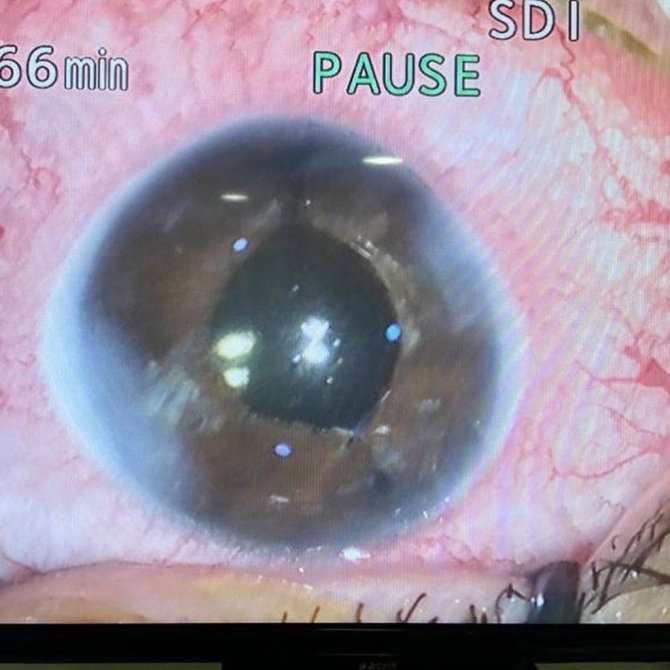 Göz Bebekleri Yere Bakan Gurbetçi İ̇zmir’de Sağlığına Kavuştu