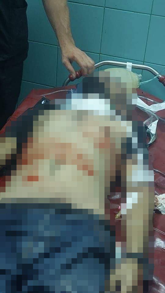 İ̇srail Güçleri 1 Filistinliyi Öldürdü, 16 Kişiyi Yaraladı