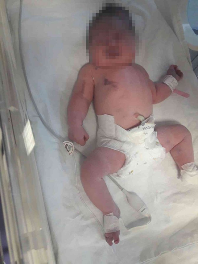 Hastanede "Temizlik Görevlisinin Doğum Yaptırdığı Bebek Sakat Kaldı" İddiası