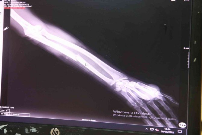 Uzmanlar Uyardı: "Elektrikli Scooter Ölüm Saçıyor"