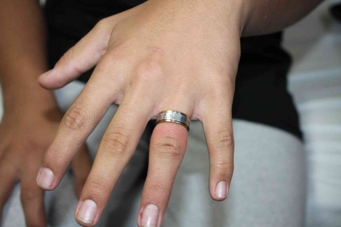 Parmağına Yüzük Sıkışan Çocuğun İmdadına Sağlık Çalışanları Ve İtfaiye Ekipleri Yetişti