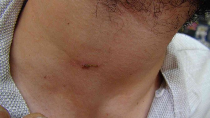 50 Liralık Kumanda İçin Dükkan Basıp, Tamirciyi Dövdüler