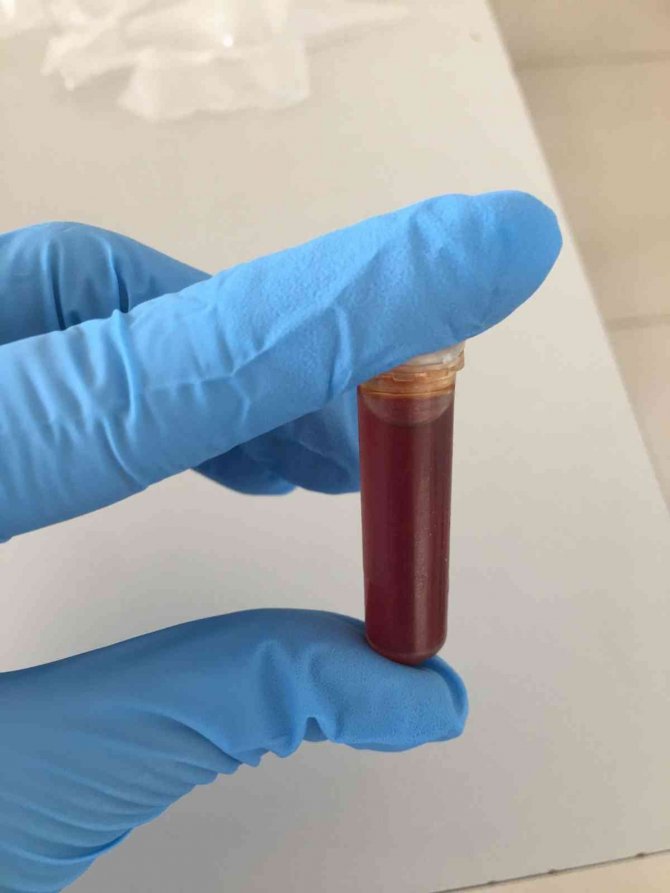 Siyah Kuşburnu Meyve Özütünün, Göğüs Kanseri Hücrelerini Yüksek Oranda Yok Ettiği Belirlendi