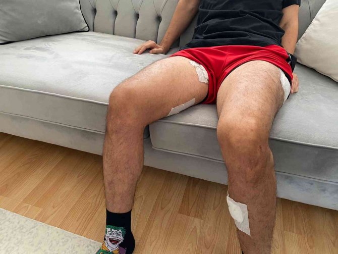 Ümraniye’de Yol Verme Kavgasında Kan Aktı: 7 Yerinden Bıçaklandı