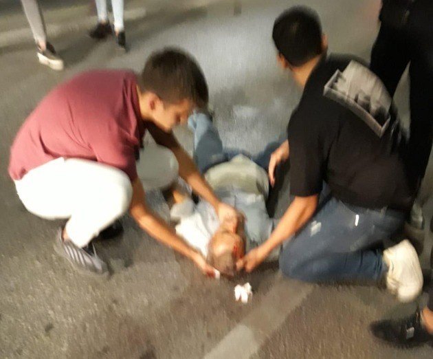 Hafif Ticari Aracın Çarptığı Yaya Ağır Yaralandı