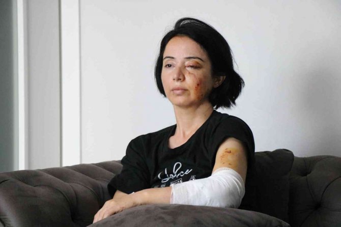 İ̇ki Köpeğin Saldırdığı Anne-kız Ucuz Kurtuldu