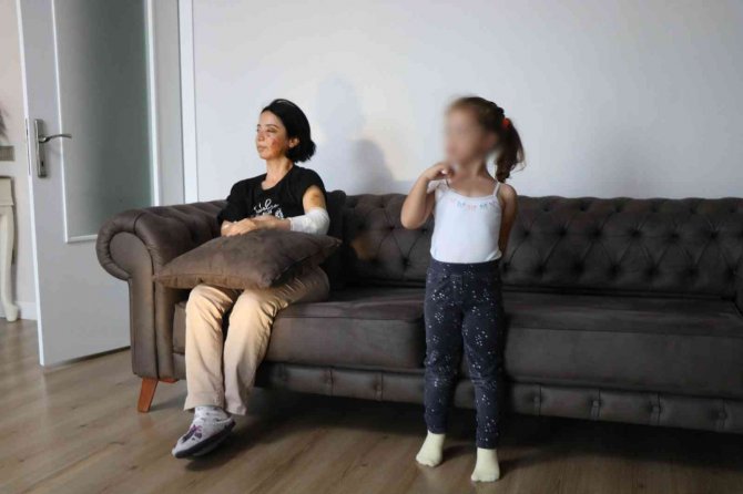 İ̇ki Köpeğin Saldırdığı Anne-kız Ucuz Kurtuldu