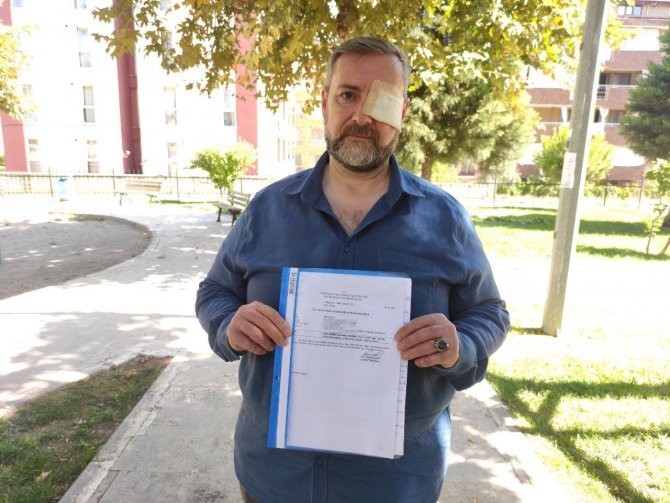 Tarihi Geçmiş Döner Satmayı Reddeden Şef Hem Gözünden Hem De İşinden Oldu