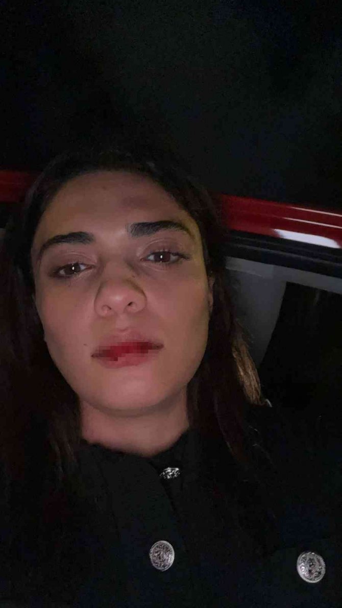 Azerbaycanlı Şarkıcı Nergiz Bagieva, İ̇stanbul’da Taksicinin Saldırısına Uğradı